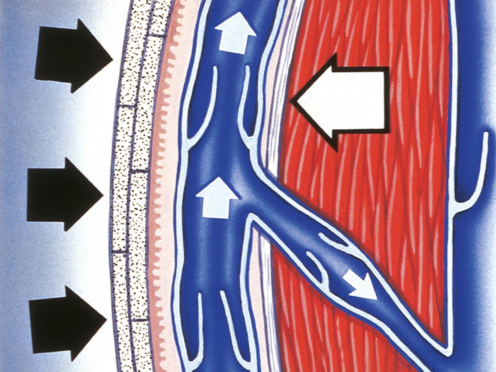 Qu'estce que la thérapie par compression
